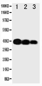 Anti-IL12 p40/IL12B Antibody Picoband® Boster Bio