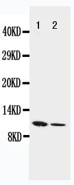 Anti-Resistin/RETN Antibody Picoband® Boster Bio