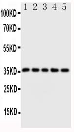Anti-Fos B/FOSB Antibody Picoband® Boster Bio