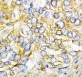 Anti-AIMP2/p38 Antibody Picoband® Boster Bio