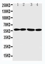 Anti-Angiopoietin-related protein 1 ANGPTL1 Antibody Picoband® Boster Bio