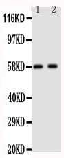 Anti-Aromatase/CYP19A1 Antibody Picoband® Boster Bio