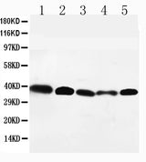 Anti-GPR2/CCR10 Antibody Picoband® Boster Bio