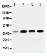 Anti-IGFBP3 Antibody Picoband® Boster Bio