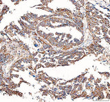 Anti-BCAT2 Antibody Picoband® Boster Bio