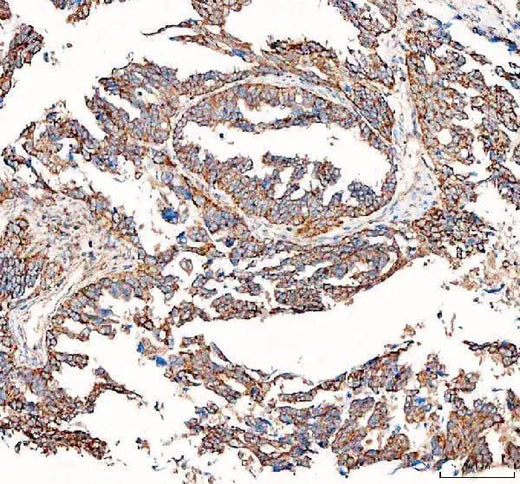 Anti-BCAT2 Antibody Picoband® Boster Bio
