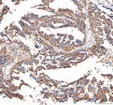 Anti-BCAT2 Antibody Picoband® Boster Bio