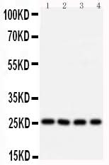 Anti-B-cell lymphoma/leukemia 10 Bcl10 Antibody Picoband® Boster Bio