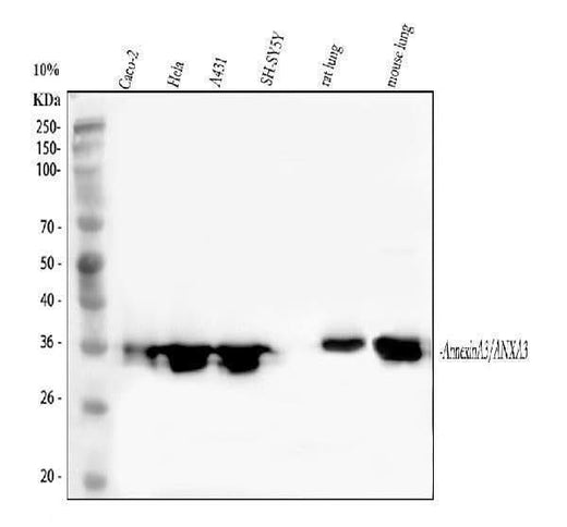 Anti-Annexin A3/ANXA3 Antibody Picoband® Boster Bio