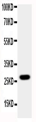 Anti-Aquaporin 8/AQP8 Antibody Picoband® Boster Bio