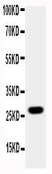 Anti-Aquaporin 8/AQP8 Antibody Picoband® Boster Bio