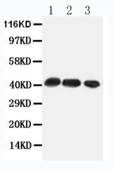 Anti-C-C chemokine receptor type 4 CCR4 Antibody Picoband® Boster Bio