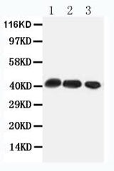 Anti-C-C chemokine receptor type 4 CCR4 Antibody Picoband® Boster Bio