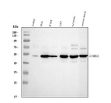 Anti-CaMKK/CAMKK1 Antibody Picoband® Boster Bio