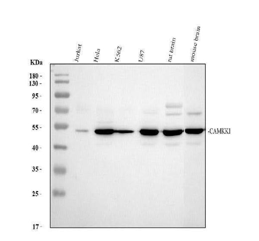 Anti-CaMKK/CAMKK1 Antibody Picoband® Boster Bio
