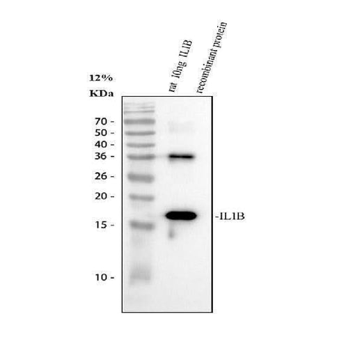 Anti-IL1 beta/IL1B Antibody Picoband® Boster Bio