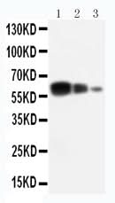 Anti-ADAM10/ADAM10 Antibody Picoband® Boster Bio