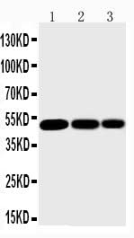 Anti-IKK gamma/IKBKG Antibody Picoband® Boster Bio