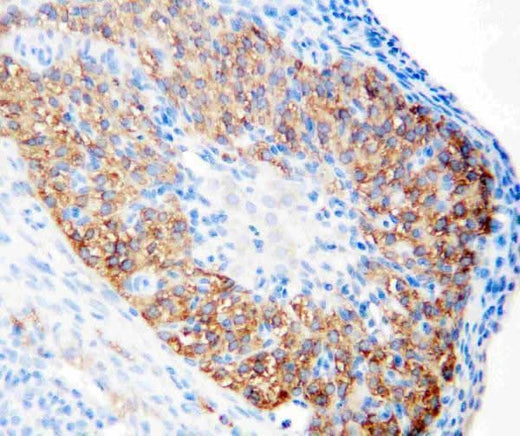 Anti-hCG receptor/LHCGR Antibody Picoband® Boster Bio