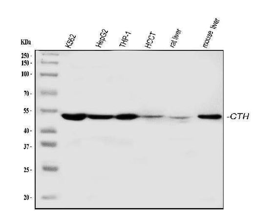 Anti-Cystathionase/CTH Antibody Picoband® Boster Bio