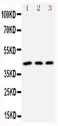 Anti-DAP Kinase 2/DAPK2 Antibody Picoband® Boster Bio
