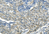 Anti-Desmoglein 2/DSG2 Antibody Picoband® Boster Bio