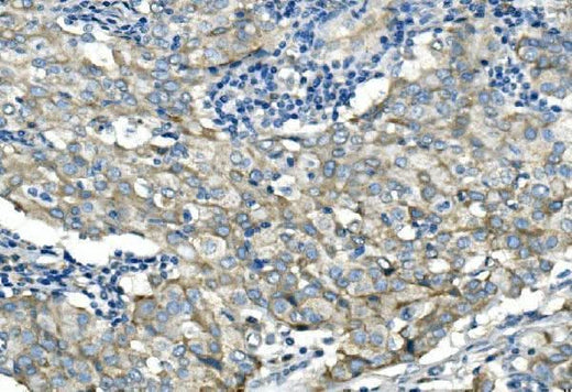 Anti-Desmoglein 2/DSG2 Antibody Picoband® Boster Bio