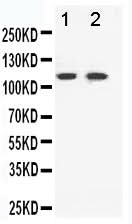 Anti-Eph receptor B3/EPHB3 Antibody Picoband® Boster Bio