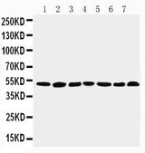 Anti-C-terminal-binding protein 1 CtBP1 Antibody Picoband® Boster Bio