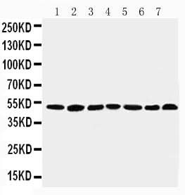 Anti-C-terminal-binding protein 1 CtBP1 Antibody Picoband® Boster Bio