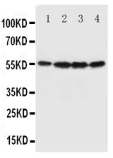Anti-Fascin/FSCN1 Antibody Picoband® Boster Bio