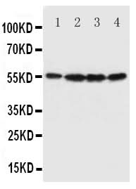 Anti-Fascin/FSCN1 Antibody Picoband® Boster Bio