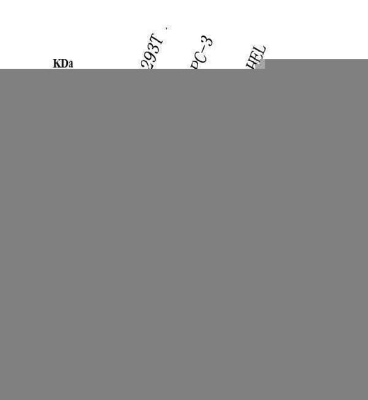 Anti-Prostaglandin E Receptor EP1/PTGER1 Antibody Picoband® Boster Bio