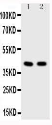 Anti-Histone deacetylase 8 HDAC8 Antibody Picoband® Boster Bio
