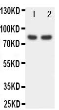 Anti-Forkhead box protein P1 FOXP1 Antibody Picoband® Boster Bio