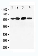 Anti-Mineralocorticoid Receptor/NR3C2 Antibody Picoband® Boster Bio