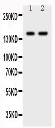 Anti-CD45/PTPRC Antibody Picoband® Boster Bio