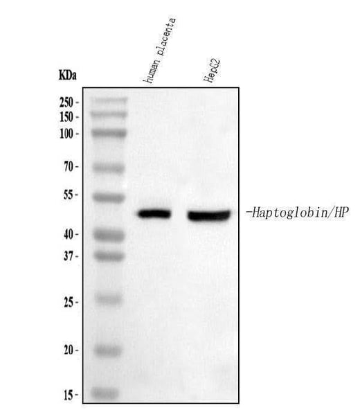 Anti-Haptoglobin/HP Antibody Picoband® Boster Bio