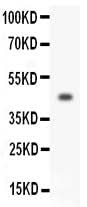 Anti-Homeobox protein Hox-A3 HOXA3 Antibody Picoband® Boster Bio