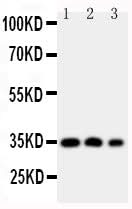 Anti-Homeobox protein Hox-A4 HOXA4 Antibody Picoband® Boster Bio