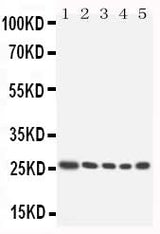 Anti-Homeobox protein Hox-A6 HOXA6 Antibody Picoband® Boster Bio
