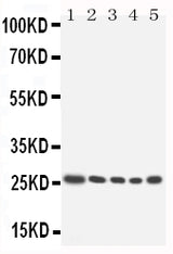Anti-Homeobox protein Hox-A6 HOXA6 Antibody Picoband® Boster Bio