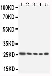 Anti-Homeobox protein Hox-A6 HOXA6 Antibody Picoband® Boster Bio