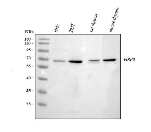 Anti-Heat shock factor protein 2 HSF2 Antibody Picoband® Boster Bio