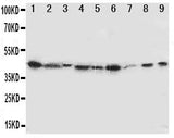 Anti-Indoleamine 2, 3-dioxygenase/IDO1 Antibody Picoband® Boster Bio