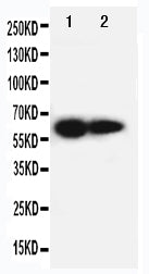 Anti-IL2 Receptor beta/IL2RB Antibody Picoband® Boster Bio
