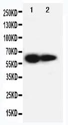 Anti-IL2 Receptor beta/IL2RB Antibody Picoband® Boster Bio