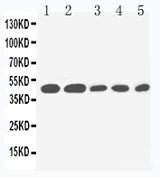 Anti-IL2 Receptor gamma/IL2RG Antibody Picoband® Boster Bio