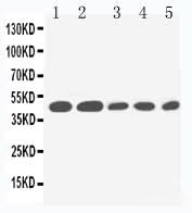 Anti-IL2 Receptor gamma/IL2RG Antibody Picoband® Boster Bio