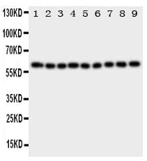 Anti-IL5RA Antibody Picoband® Boster Bio